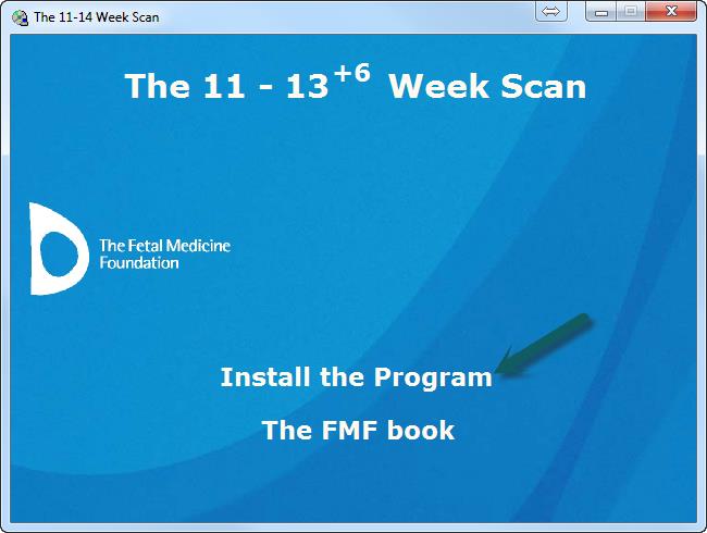 NTUEMP - Instructions for migrating FTS Program - Sybase Install Step 02